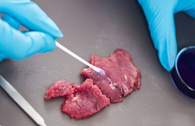 Enfermedades transmitidas por alimentos