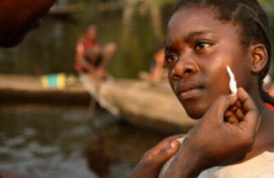 Young woman received treatment