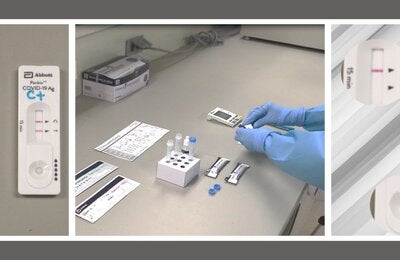 Pruebas de detección de antígenos de SARS-CoV-2