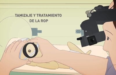 curso-manejo-de-la-retinopatia-del-prematuro