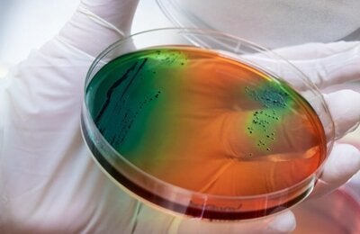 La iniciativa contempla estrategias para el período 2021 - 2025 para enfrentar en conjunto las enfermedades infecciosas a través del resguardo de la eficacia de los antimicrobianos