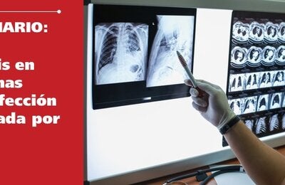 Micosis en personas con infección avanzada por el VIH  en la Región de las Américas 