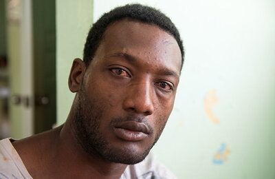 Ojos rojos: Algunas personas presentan conjuntivitis como consecuencia de la fiebre. Los ojos rojos en este hombre son un signo de la alta temperatura que presenta.