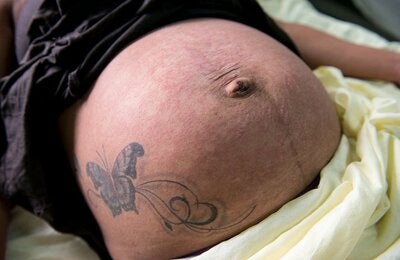 Embarazadas: Una embarazada con erupciones en su piel consulta a un médico. Durante las primeras semanas del embarazo y la última previa al parto estas requieren especial atención. Se recomienda prevenir las picaduras con mosquiteros, repelente y ropa de manga larga.