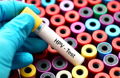 HPV testing