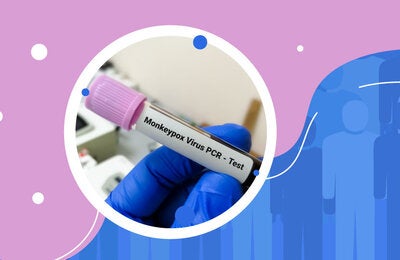 MONKEYPOX E REUNIÕES EM MASSA