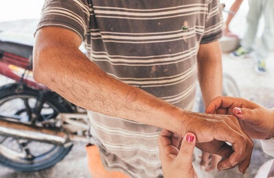 Control de la leishmaniasis