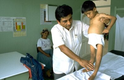 © PAHO/WHO Peru, Junin | 1991. Little Luis Fermín Tenorio Cortez the last polio case reported in the Americas. 