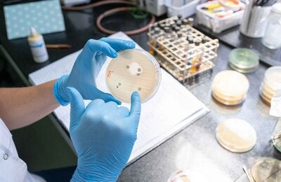 La imagen muestra la detección de mecanismos de resistencia utilizando un método manual.