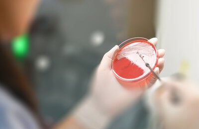 Prueba de laboratorio de patógenos resistentes a los antibióticos 