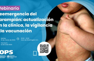 Reemergencia del sarampión