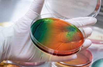 colorful image of a petri dish