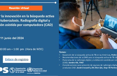 Acelerar la innovación en la búsqueda activa de la tuberculosis. Radiografía digital y detección asistida por computadora (CAD)