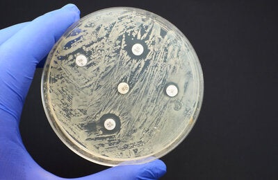 Antimicrobial sensitivity test