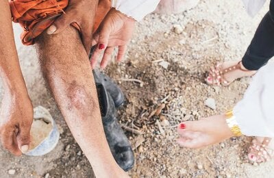 Historia de éxito: Primeras victorias contra la Leishmaniasis