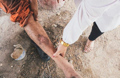 Persona con lesión característica de la leishmaniasis cutánea