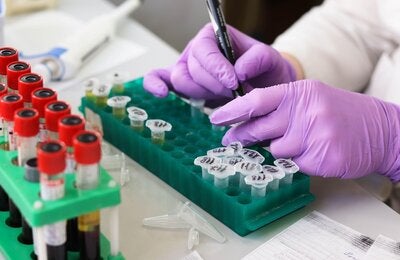 laboratory technician hands.