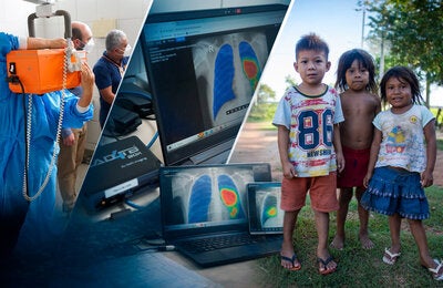 We can end tuberculosis