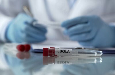Prueba de ebola