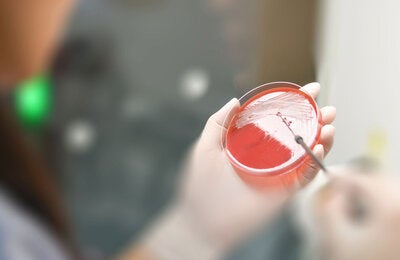 Lab technicians working on the media plate to culture and bacteria and drug resistance of pathogens in hospital laboratory