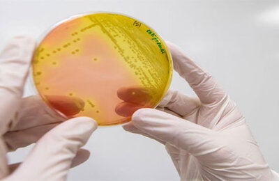 foto de bacteria en un  recipiente