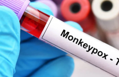 En Ecuador, más de 500 personas participaron en el seminario virtual sobre viruela símica