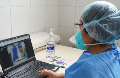 IA asiste en el diagnóstico de la tuberculosis