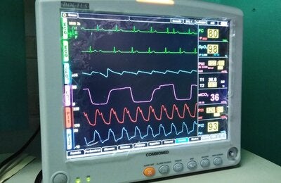 Monitor multiparamétrico