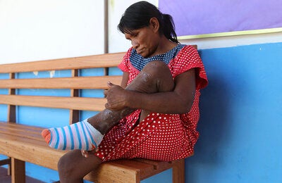 Tungiasis and the guardians of the Amazon