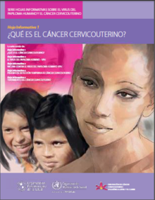 ¿Qué es el cáncer cervicouterino?