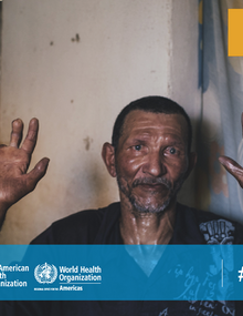 Leprosy can be cured; 2019