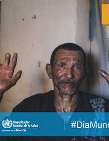 Facebook: La lepra se puede curar; 2019