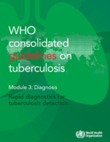 WHO consolidated guidelines on tuberculosis Module 3: Diagnosis - Rapid ...