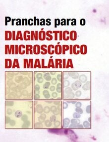 Pranchas para o Diagnóstico Microscópico da Malária