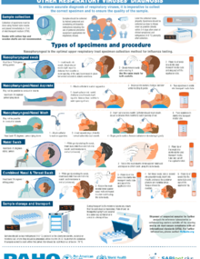 Respiratory sample collection for Influenza and other respiratory viruses diagnosis - Infographic