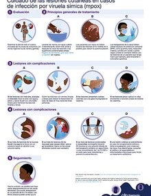 Cuidado de las lesiones cutáneas en casos de infección por viruela símica (mpox)