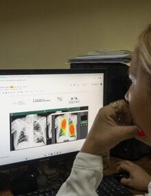 Imaging being used to diagnose tuberculosis