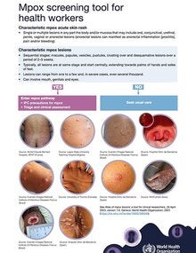 Mpox screening tool for health workers