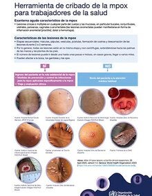 Herramienta de cribado de la mpoxpara trabajadores de la salud