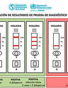 INTERPRETACIÓN DE RESULTADOS DE PRUEBA DE DIAGNÓSTICO RÁPIDO (PDR)