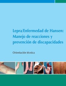 Lepra/Enfermedad de Hansen: Manejo de reacciones y prevención de discapacidades. Orientación técnica