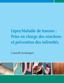 Lèpre / Maladie de hansen: Prise en charge des réactions et prévention des infirmités