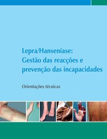 Lepra/Hanseníase: Gestão das reacções e prevenção das incapacidades. Orientações técnicas