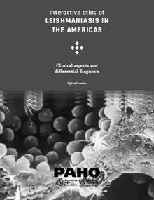 Interactive atlas of leishmaniasis in the Americas: Clinical aspects and differential diagnosis. Updated version