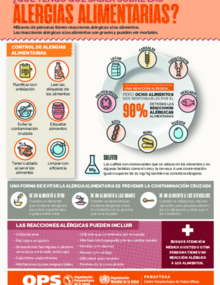 Infografía: ¿Que tengo que saber sobre las alergias alimentarias?