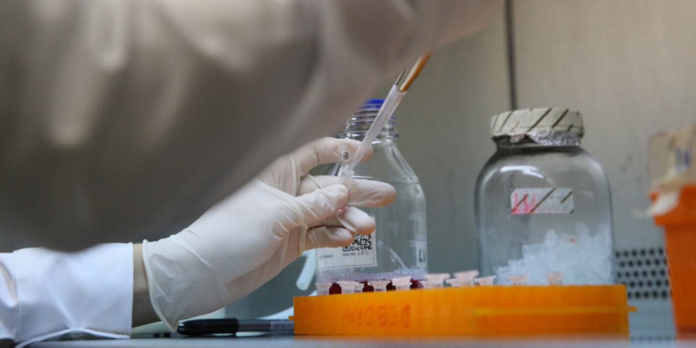 La iniciativa ShORRT sobre la investigación de la tuberculosis en la Región de las Américas