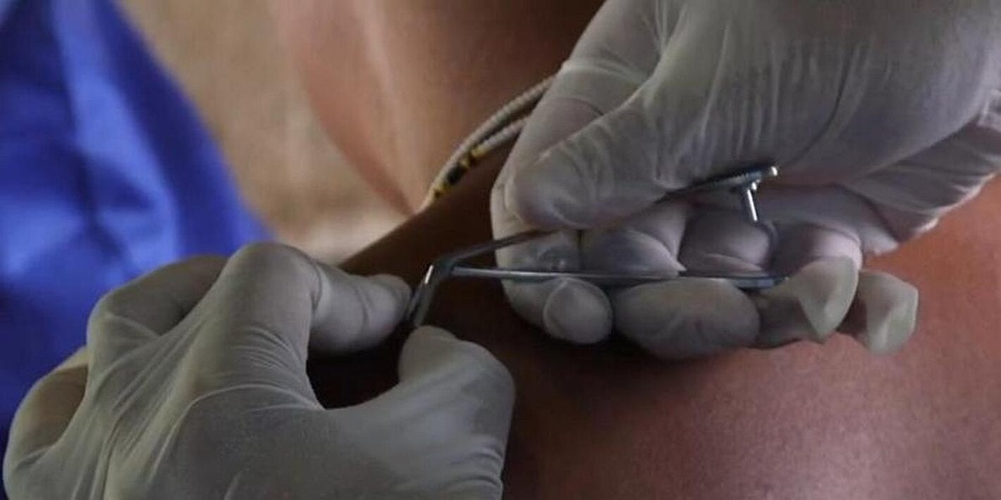 La OPS/OMS y el Centro Carter felicitan a Ecuador por lograr la eliminación de la oncocercosis