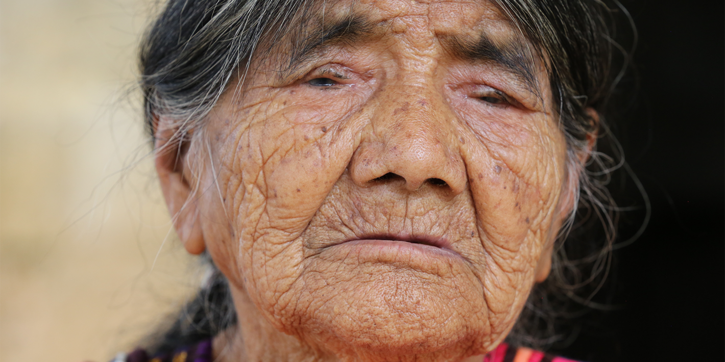 Ojos que renacen: La eliminación del tracoma en México