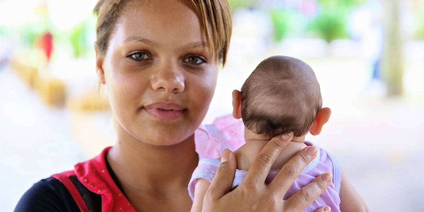 mother holding baby with microcephaly