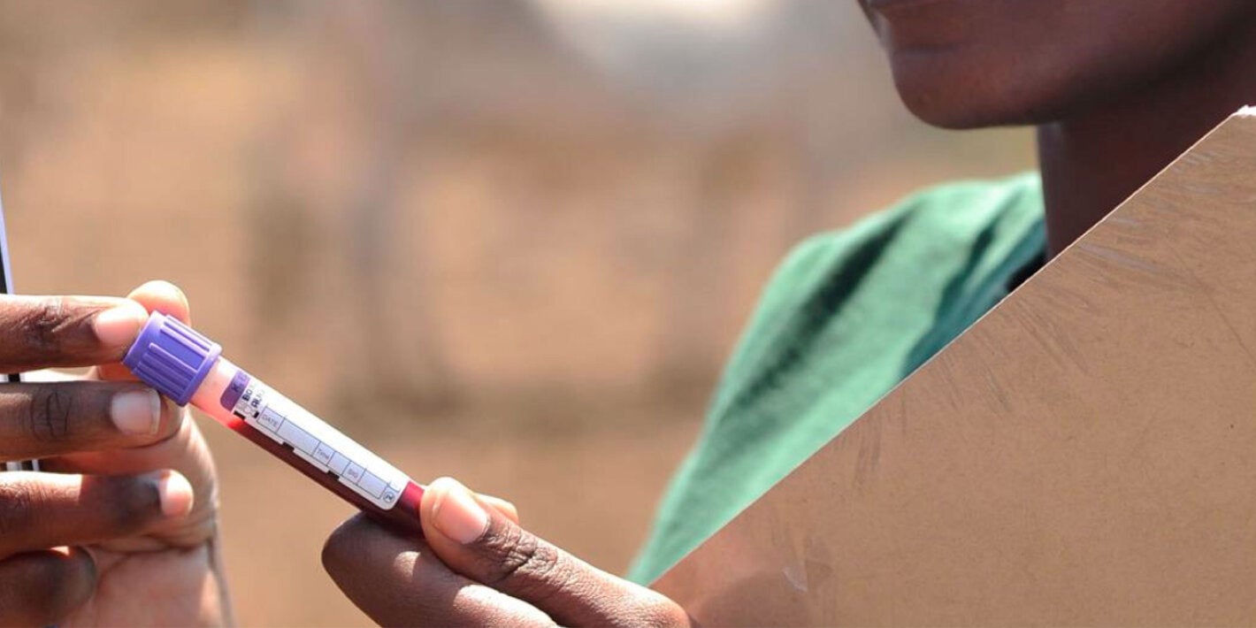 Blood sample for ferritin test